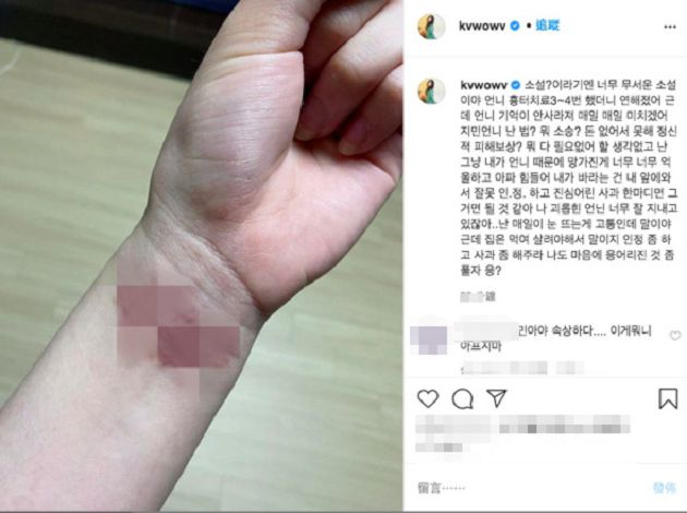 震撼彈！AOA珉娥PO「條碼手腕」控訴：被隊長智珉霸凌長達10年