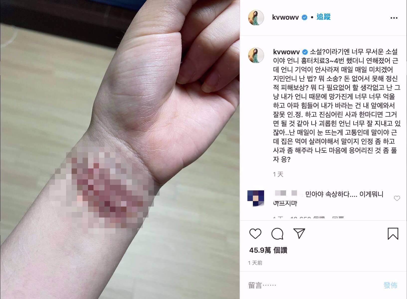 智珉退出AOA！FNC發聲明「活動無限期中斷」 她IG上道歉：沒領導好團隊