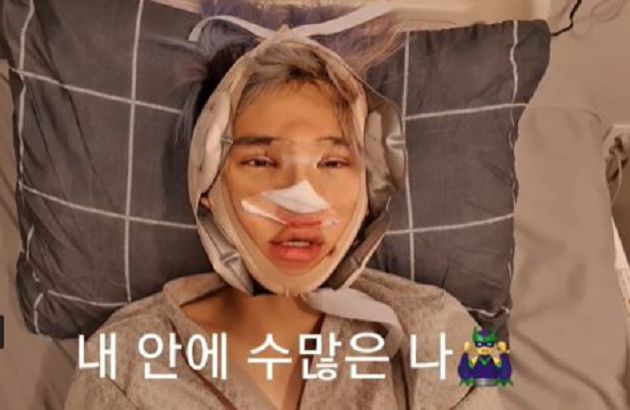 整形過程全公開！韓知名饒舌歌手「腫成豬頭」樣子曝光：變身花美男