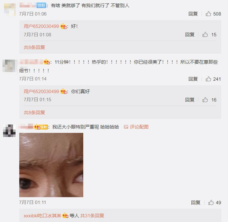 整形疤痕再被翻!網抓包周揚青「眼睛上面一整條」 經紀人曝光暖心舉動