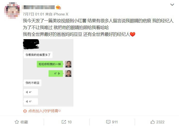 整形疤痕再被翻!網抓包周揚青「眼睛上面一整條」 經紀人曝光暖心舉動