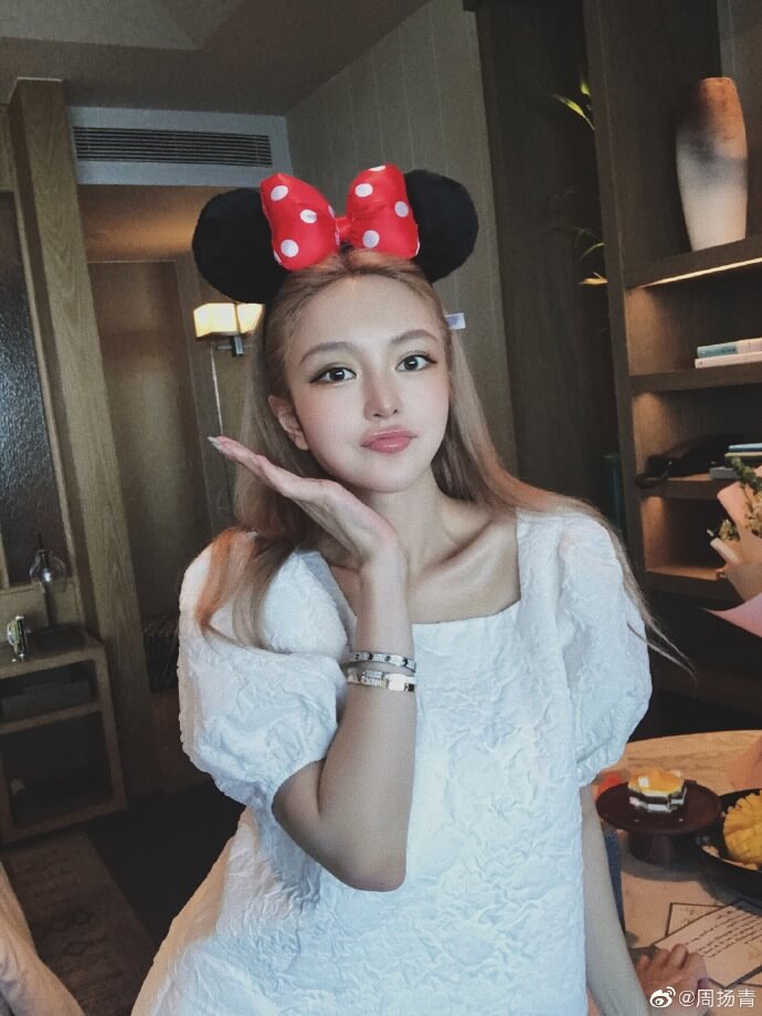 整形疤痕再被翻!網抓包周揚青「眼睛上面一整條」 經紀人曝光暖心舉動