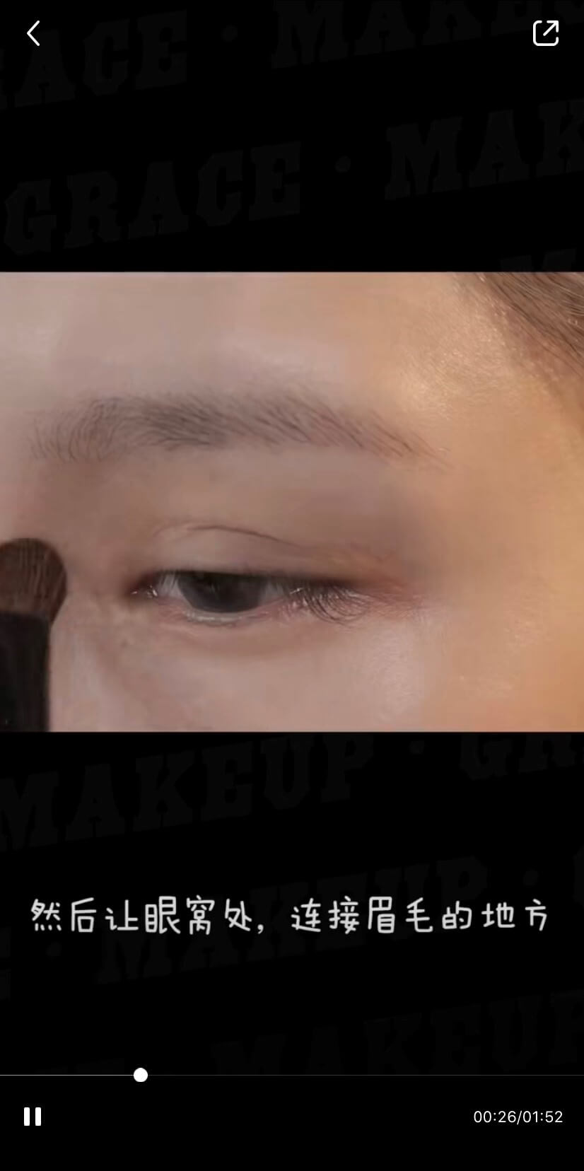 整形疤痕再被翻!網抓包周揚青「眼睛上面一整條」 經紀人曝光暖心舉動