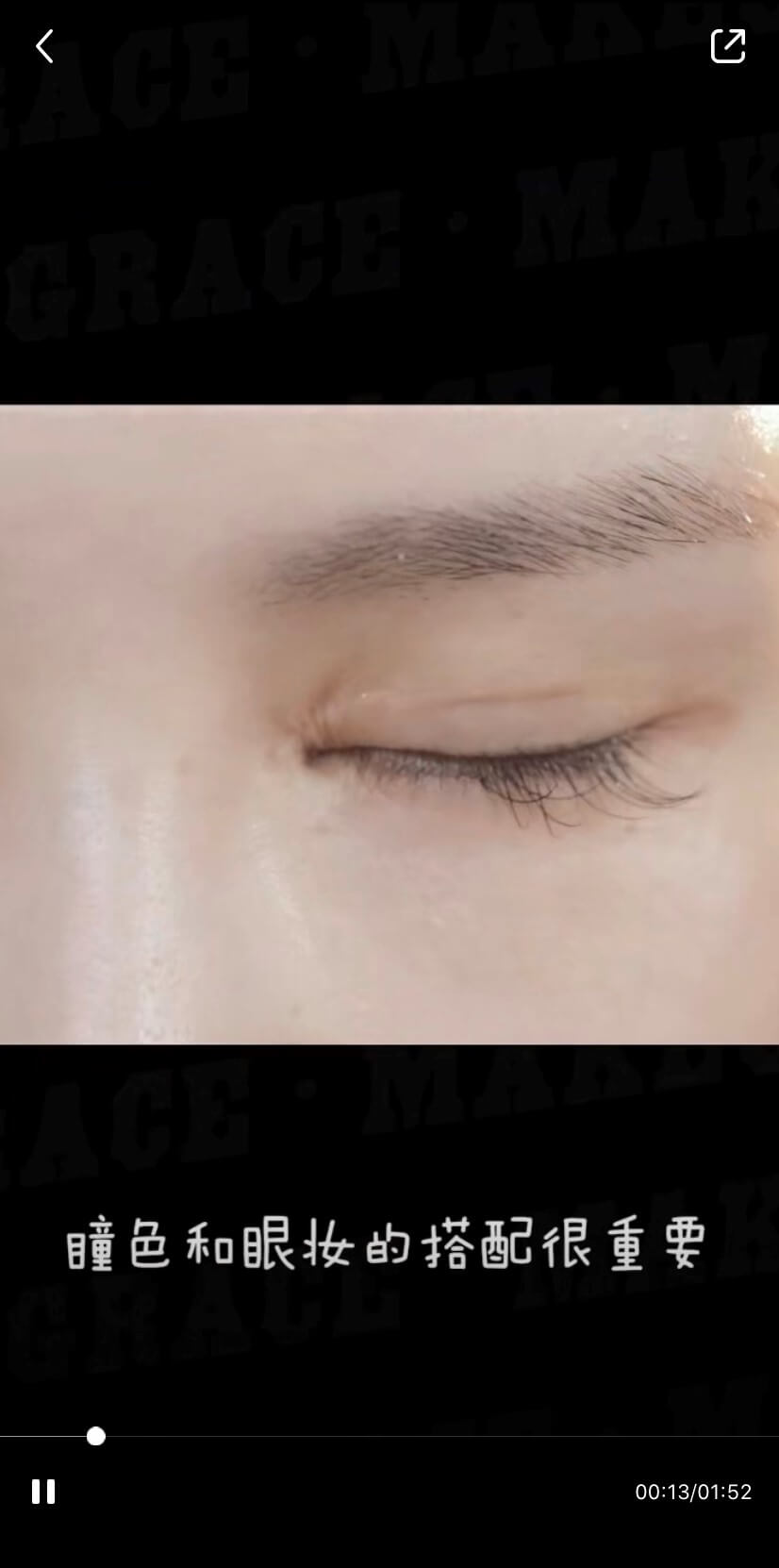 整形疤痕再被翻!網抓包周揚青「眼睛上面一整條」 經紀人曝光暖心舉動