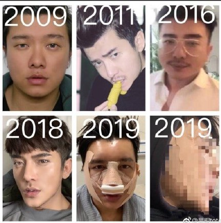 真面目嚇壞！網紅公開「勵志整形+甩肉過程」：肥胖大叔變身金城武！