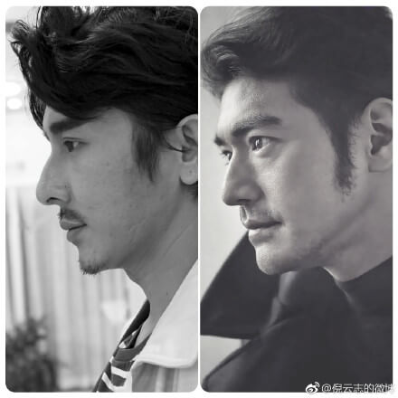 真面目嚇壞！網紅公開「勵志整形+甩肉過程」：肥胖大叔變身金城武！