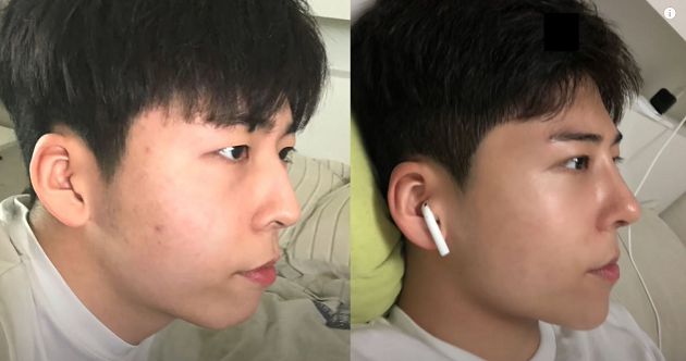 挨批根本不像朴寶劍!網紅「直接整形」遭網酸:朴塑膠?