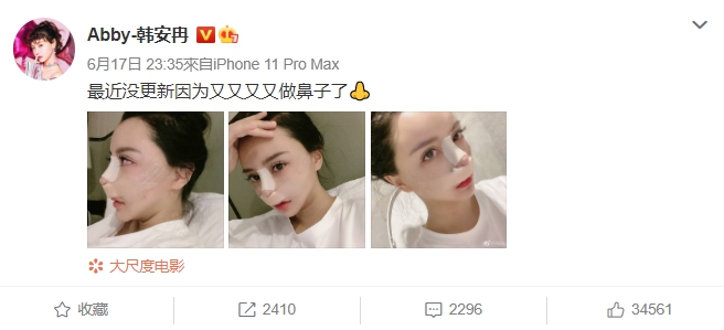 第35次整形！百萬網紅「整到快沒鼻孔」　網嚇歪：確定還能呼吸？