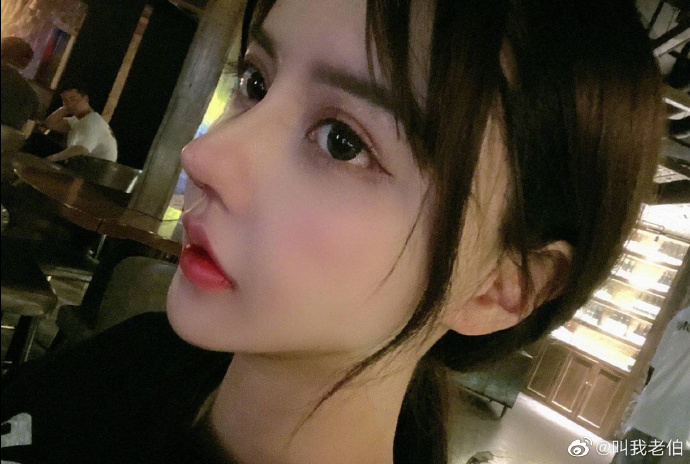 第35次整形！百萬網紅「整到快沒鼻孔」　網嚇歪：確定還能呼吸？