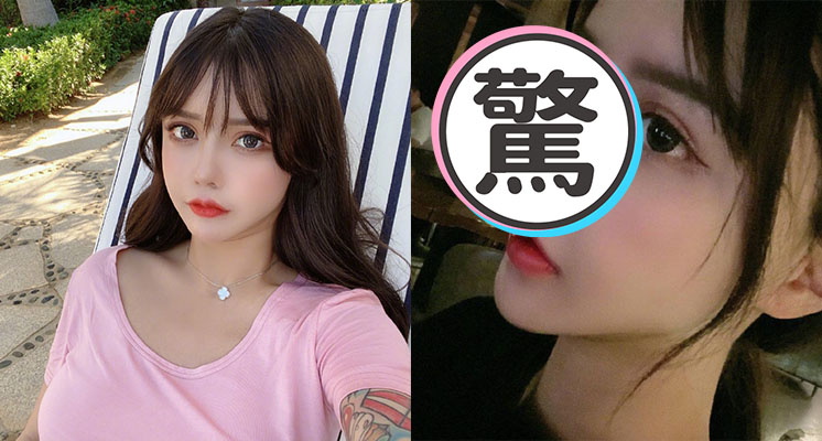 第35次整形！百萬網紅「整到快沒鼻孔」　網嚇歪：確定還能呼吸？