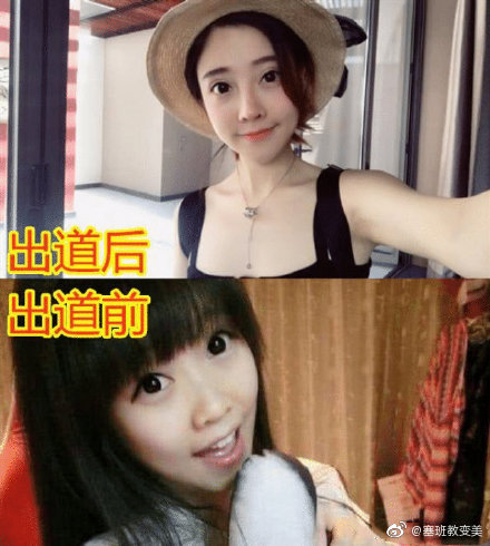 整形前「醜小鴨照」遭起底瘋傳 馮提莫遭諷「行走整容大全」