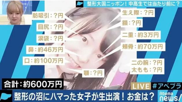 2年狂噴169萬！日本普妹「整成橋本有菜」：初戀跟仇人在一起