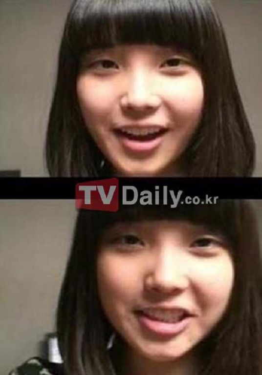 IU素顏照曝光!「單眼皮舊照」再被翻出 網全看歪:真的差好多