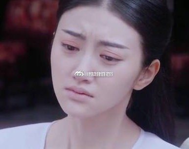 把自己整成悲傷蛙！女星「自曝整形黑歷史」：每天都想哭