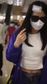 《功夫》啞女「近況曝光」!拍戲爆頭「驚悚照」流出 網嚇歪:節目被詛咒?