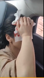 《功夫》啞女「近況曝光」!拍戲爆頭「驚悚照」流出 網嚇歪:節目被詛咒?