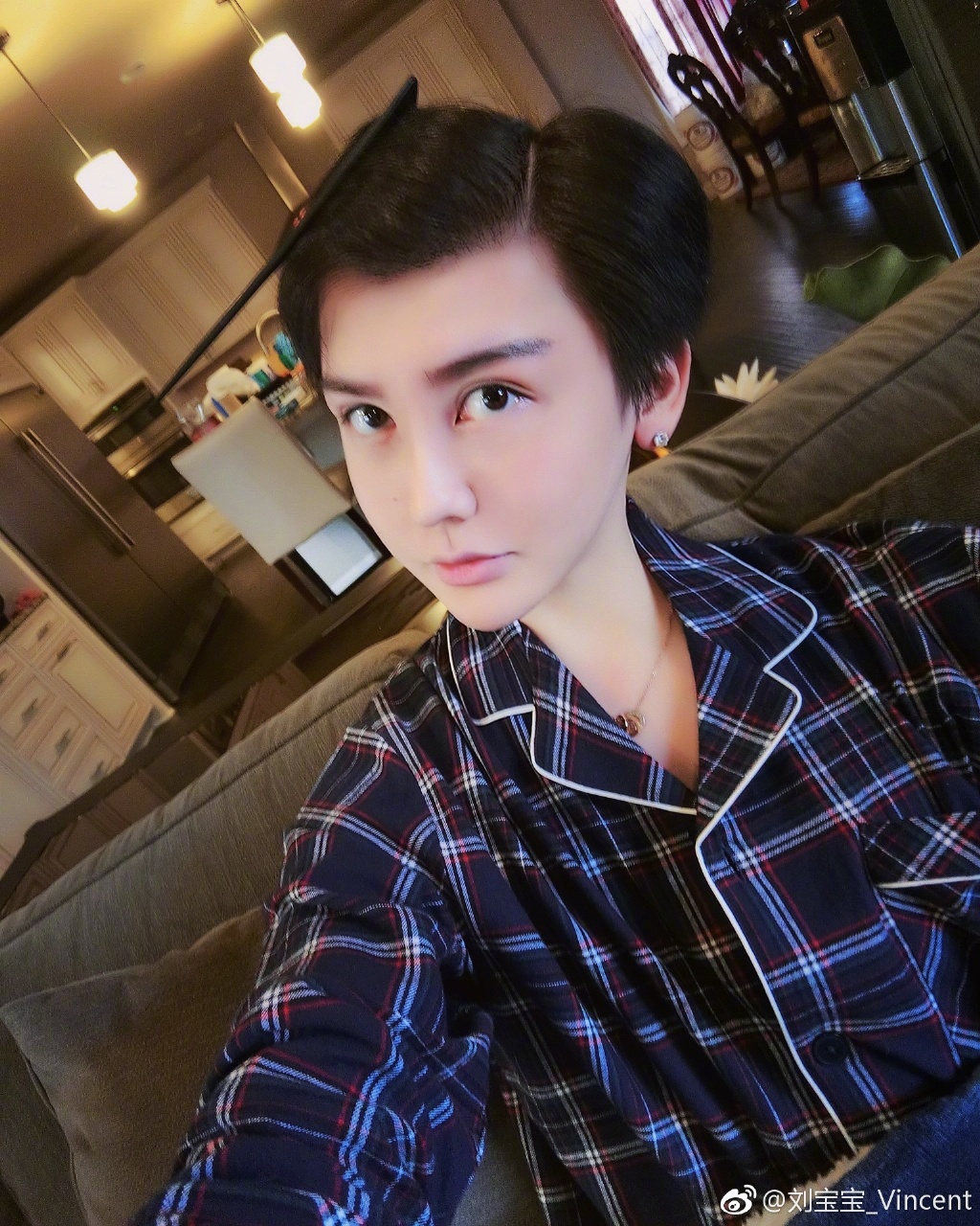 全臉毀容!蛇精男爆「滿臉爛痘」驚悚近照曝光 網嚇歪:得病了?