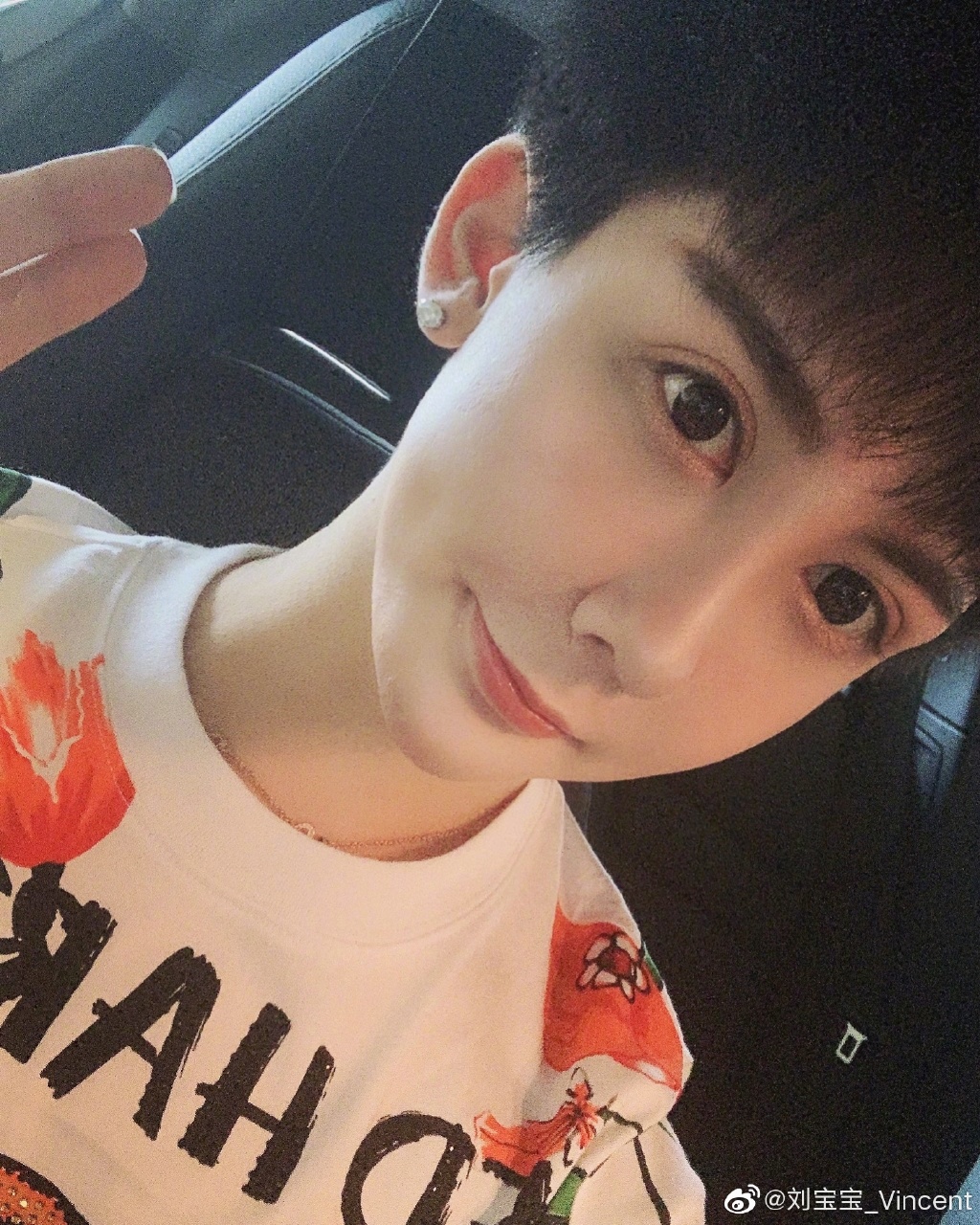 全臉毀容!蛇精男爆「滿臉爛痘」驚悚近照曝光 網嚇歪:得病了?