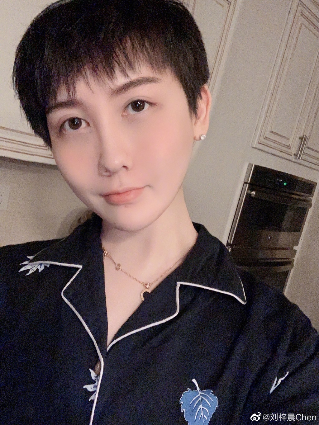 全臉毀容!蛇精男爆「滿臉爛痘」驚悚近照曝光 網嚇歪:得病了?