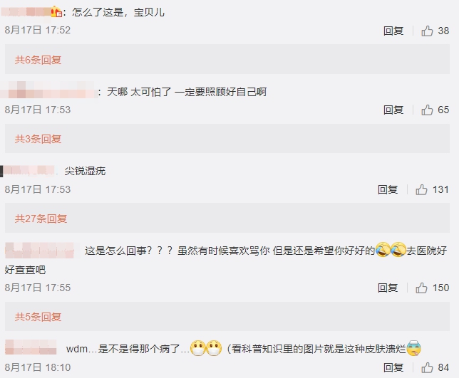 全臉毀容!蛇精男爆「滿臉爛痘」驚悚近照曝光 網嚇歪:得病了?