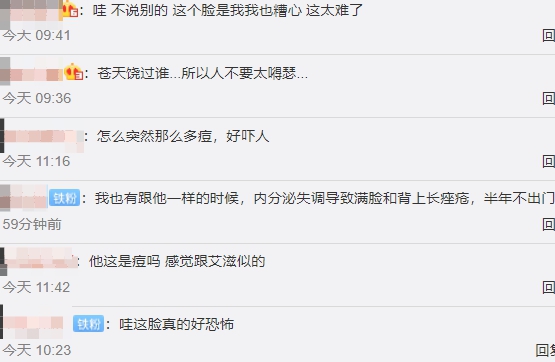 全臉毀容!蛇精男爆「滿臉爛痘」驚悚近照曝光 網嚇歪:得病了?