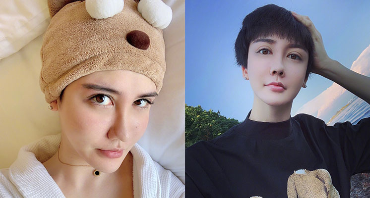 全臉毀容！蛇精男爆「滿臉爛痘」驚悚近照曝光　網嚇歪：得病了？