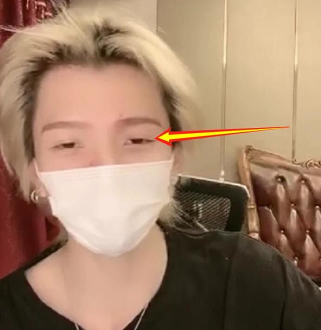 口罩摘下「秒變鴨嘴獸」!電眼鮮肉「素顏真面目曝光」 網怒:整張臉都是假的