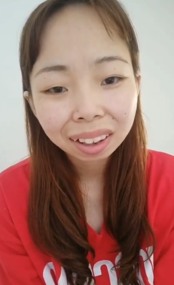 「快手嘟嘟姐」近況曝光！2年後「暴牙凸嘴」消失　網全嚇歪：美炸！