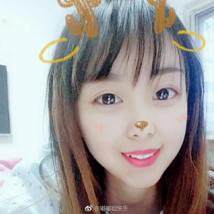 「快手嘟嘟姐」近況曝光！2年後「暴牙凸嘴」消失　網全嚇歪：美炸！