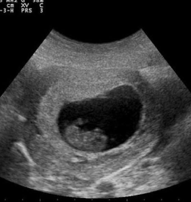 懷孕也不管！女團成員「PO超音波」罵中國金主　前經紀公司：假的！