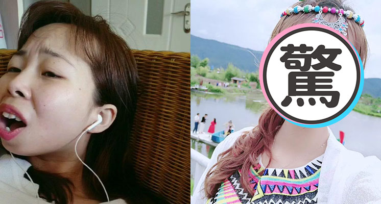 「快手嘟嘟姐」近況曝光！2年後「暴牙凸嘴」消失　網全嚇歪：美炸！