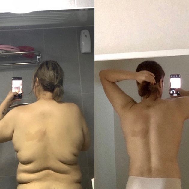 吃播直播主「狂甩44公斤」!肚子三層肉全消風 對比照曝光網看歪