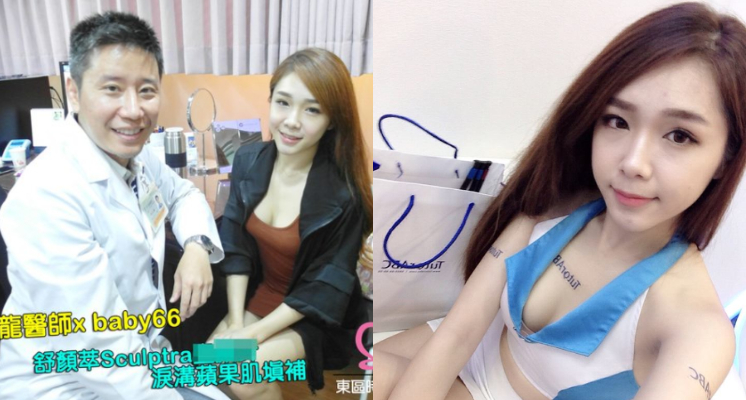 「胸狠」實況主Baby 66因作風大膽，常常在開台時不吝嗇展現自己的好身材，加上甜美臉蛋和笑容，讓許多男性粉絲都為之瘋狂。但PTT上卻出現一篇標題為《台女大奶實況主baby66的八卦》的文章，結果意外挖出66的整形照。  Baby66在2015年時，曾至台北東區某間「時尚美學診所」維修，照片上她與整形醫師開心合照，還標註此次前往醫美診所的目的是為了填補「淚溝」和「蘋果肌」。  循線找到該診所網頁後，發現其資料寫得十分詳細，不但有Baby66術前術後的對比照，還有手術過程的照片。而文案上也打出「美美的Baby66又來東區時尚美學診所囉！！」 底下網友也紛紛留言：「一個字 塑！」、「臉越整越怪」、「還可以啦 問題不大」、「好像王少偉扮女裝」、「我女友做醫美的 不敢說100%  但鼻子…..嗯」。